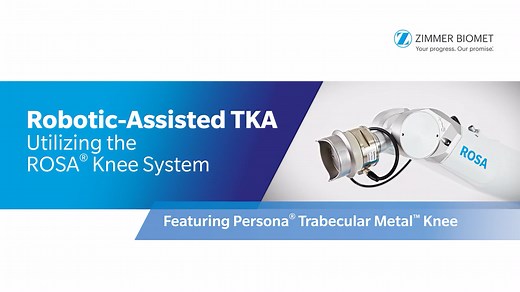 Robotic-Assisted TKA Utilizing the ROSA® Knee System Featuring Persona® Trabecular Metal™ Knee and the Persona® Medial Congruent Bearing