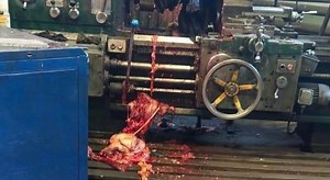 The Russian lathe accident aftermath pics(repost)