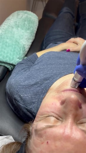 Diamond microdermabrasion = instant glow deep clean you can see ✨ This treatment gently exfoliates the top layer of dead skin while lifting away built-up oil, debris, and congestion from your pores. Wait to see the “gunk” we removed 👀 That’s dead skin, trapped oil, makeup residue, and environmental buildup. Results you’ll notice right away: • Smoother texture • Brighter, more even tone • Clearer pores • Better product absorption • Makeup sits flawlessly Perfect before events, for dull skin, con