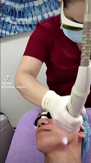 Laser Genesis Treatment #SkinPhilosophie #DrKylaTalens