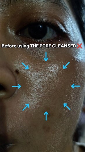 Best Deep pore cleanser for open pores and textured skin #cleanser #skincare #beauty #fyp #viral