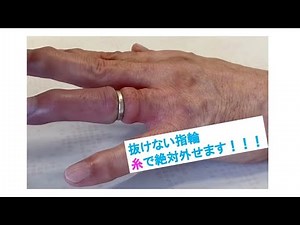 抜けない指輪の外し方 糸で誰でも簡単に！電気メスで火傷の危険 How to remove the ring
