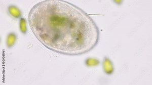 Bacteria and Protozoa in waste water under the microscope. Stock Video