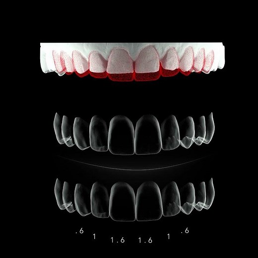 loop 3D DSD DIGITAL SMILE DESIGN