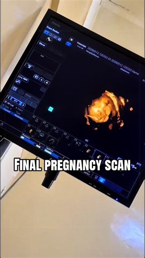Final pregnancy scan: why a third-trimester ultrasound matters