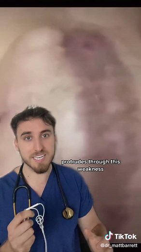Male Pregnancy Explained: Myths and Facts