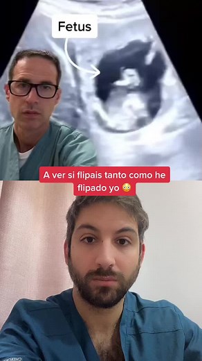 El increíble caso del embarazo ectópico