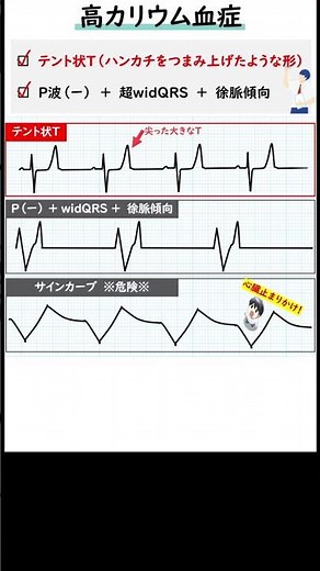 Listen to this 1-minute electrocardiogram: "Hyperkalemia" ECG Certification Level 4 and 3