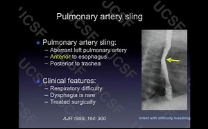 60 （腹部透视）Fluoroscopy