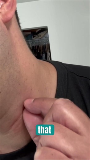 Skin Tag Comes Off Using Tea Tree Oil