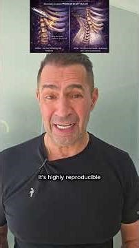 Rib Remodelling: How Floating Ribs Define the Waist in Body Feminisation