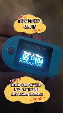 POTS Demonstration - Postural Orthostatic Tachycardia Syndrome