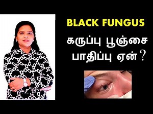What is Black Fungus? | Mucormycosis Explained in Tamil
