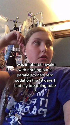 Intubated Awake Trend Explained