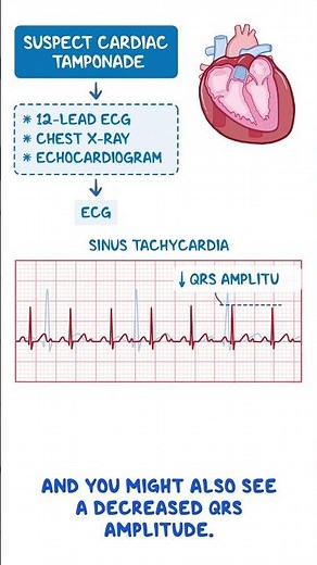 Diagnostics on Demand: Cardiac tamponade