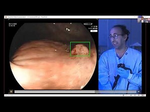 Artificial intelligence in Endoscopy