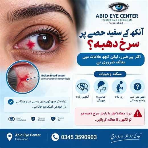 👁️ Red Spot on the White Part of Your Eye? Causes & When to See a Doctor. #abideyecenter #faisalabad