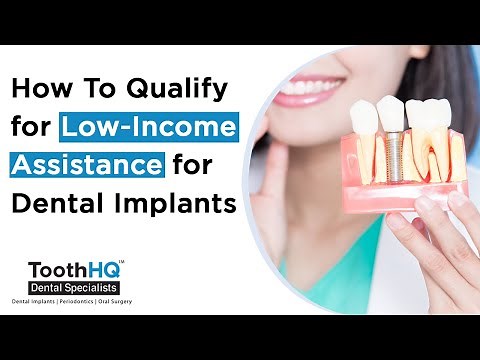 How To Qualify for Low Income Assistance for Dental Implants ToothHQ Dental Implant Special
