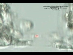 Staccato Laser - Inner Cell Mass Excision