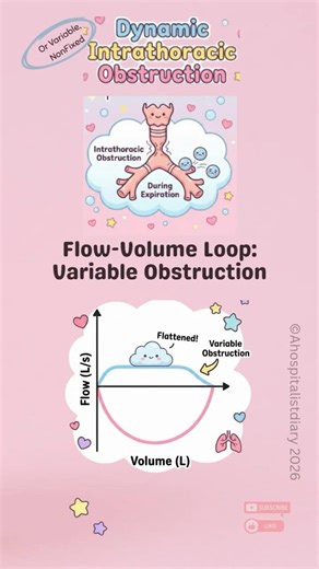 Master PFTs in 3 Minutes:The Dynamic Intrathoracic Obstruction Loop🧠⏱️ | USMLE & Respiratory Review