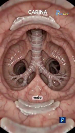 Bronchoscopy