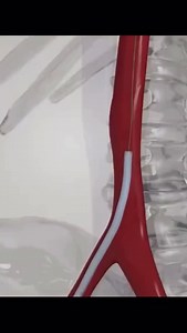 1.8K views · 379 reactions | What procedure is this? Repost: @anatomia.geral #respiratorytherapy #respiratorytherapist #respiratorytherapystudent #respiratorytherapyzone #respiratorycare #respiratorytherapyschool #heart #cardiology | Respiratory Therapy Zone | Facebook