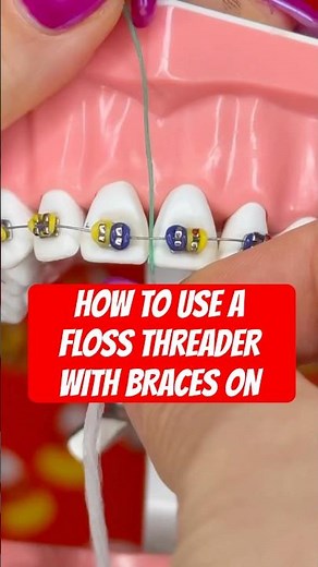HOW TO USE A FLOSS THREADER WITH BRACES 🦷 #braces #floss #teeth