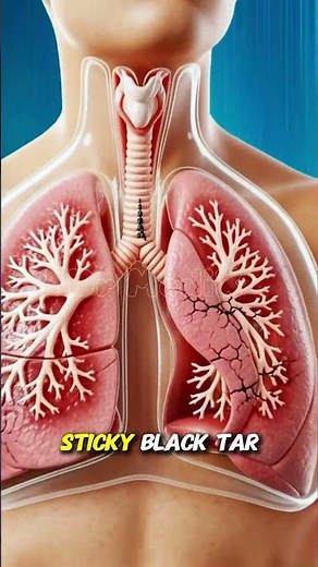 How Smoking Kills You