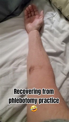 I needed a blood draw, and the phlebotomist admitted that he was still new. Happy to help...