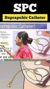 Suprapubic Catheter (SPC) in 60 Seconds! 💉. #urodynamics Bladder Se Direct Connection! 😲 #shorts