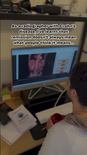 What Doctors Mean by ‘Remission’ (And Why It Can Be Misleading)
