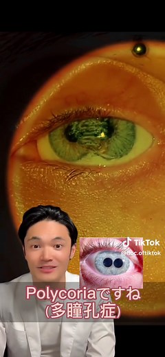 #医者 #メラノーマ #義眼 @ApocalypticAutopsy @Li に返信