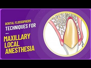 MAXILLARY LOCAL ANESTHESIA TECHNIQUES | INFILTRATIONS | NERVE BLOCKS | ORAL SURGERY | LA | BDS.
