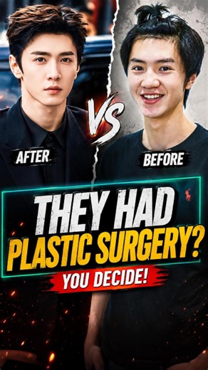C-Drama Actors Plastic Surgery Rumors #chenzheyuan #chenglei #liuyuning