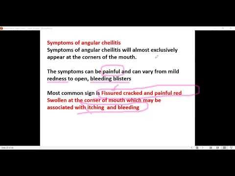 Angular cheilitis,lmaf paramedical course,প্যারামেডিকেল পল্লী চিকিৎসা