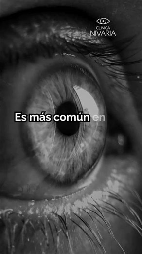 ¿Qué es el Pterigion y cuáles son sus causas?