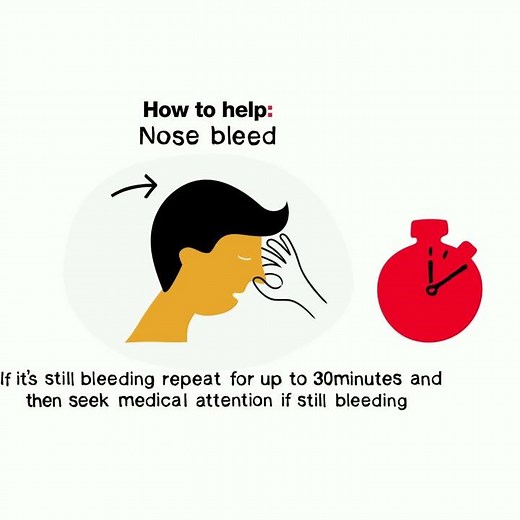 How to help someone with a nosebleed | British Red Cross | First Aid