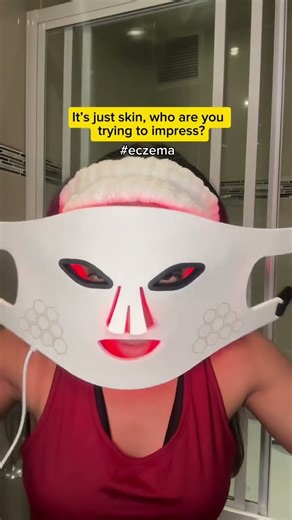 It’s just skin, who are you trying to impress? #eczema