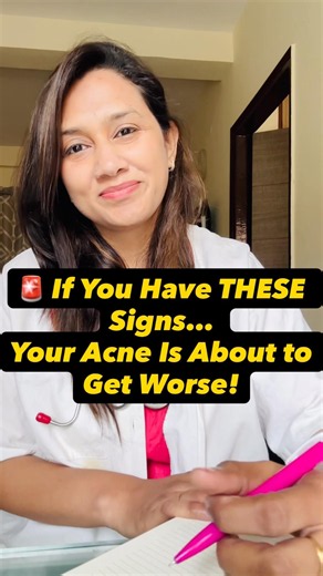 🚨 Teen Acne? Whiteheads? Oily Skin? Best Acne Skincare Routine for Clear Skin!
