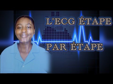 UNDERSTANDING NORMAL AND PATHOLOGICAL ECGS STEP BY STEP