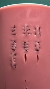 9 sutures comparison (part 1): simple buried suture | Doctor's Life