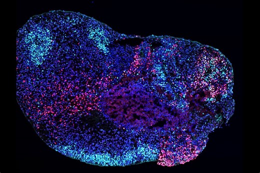 UCLA researchers find how epilepsy genes disrupt different brain regions using stem cell models