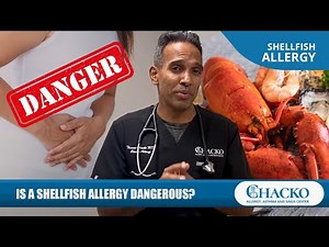 Is a Shellfish Allergy Dangerous? [Chacko Allergy]