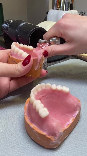 Complete Removable Denture: A Guide to Dental Prosthetics