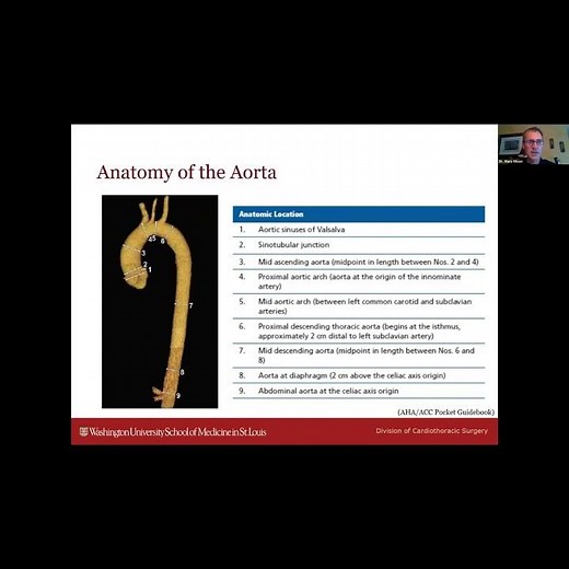 Anatomy of the Aorta