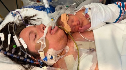 Michigan mom delivered her baby and survived open heart surgery on the same day