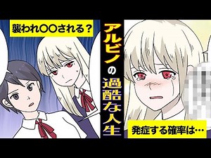 【マンガ】もしもアルビノに生まれたらどうなる？【漫画動画】