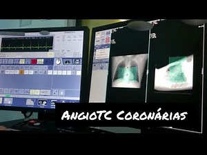 CORONARY CT ANGIOGRAPHY - IN PRACTICE