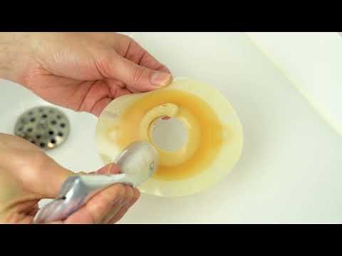 Fitting the Stoma Base Plate (2-Piece System), Step-by-Step Guide