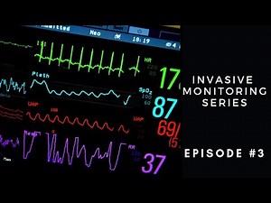 Invasive Monitoring Series Episode #3: Interpreting CVP and Art Lines with Pulmonary Dysfunction